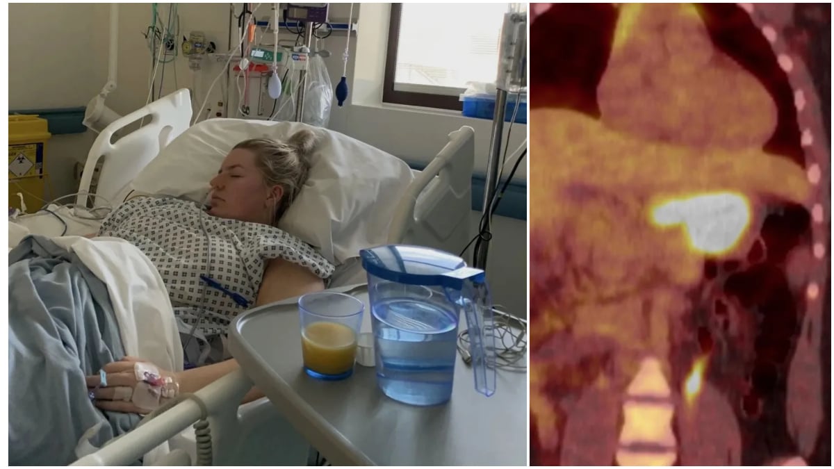 Bella-Bayliss-with-her-cancer-in-the-hospital